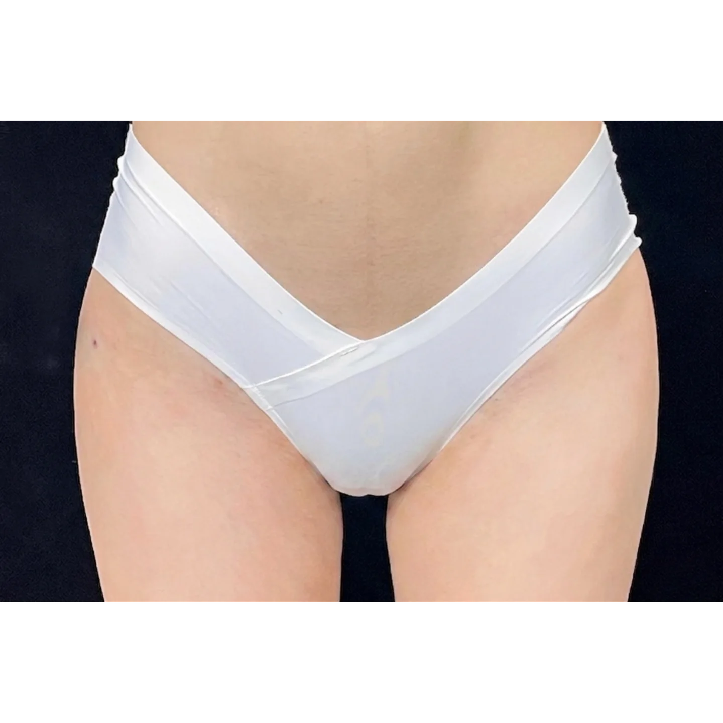 After — Waist & Hip — Body